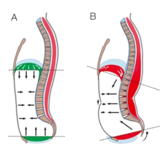Comparison diagram of good versus poor spinal stability and diaphragm function